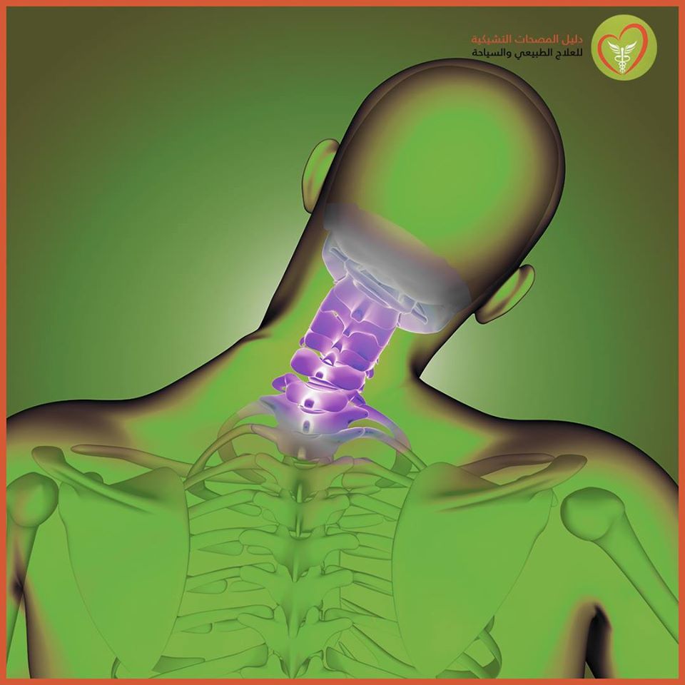  آلام الرقبة